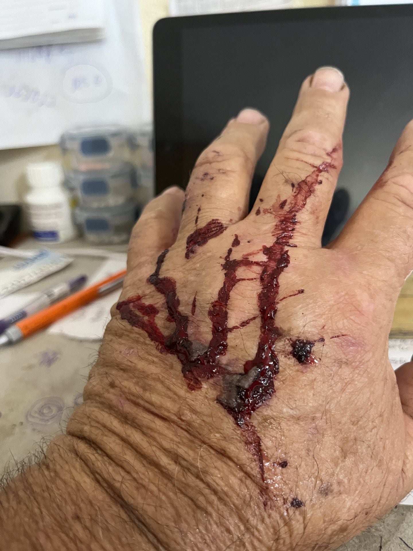 Paul Gibbs said he was bitten on the hand when he attempted to stop the owner of the dogs from leaving his property. Photo / Supplied