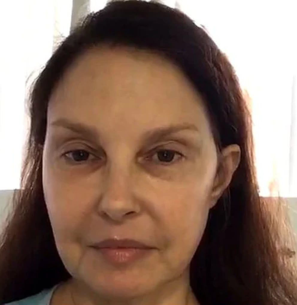 Actress Ashley Judd in ICU after shattering leg in the Democratic