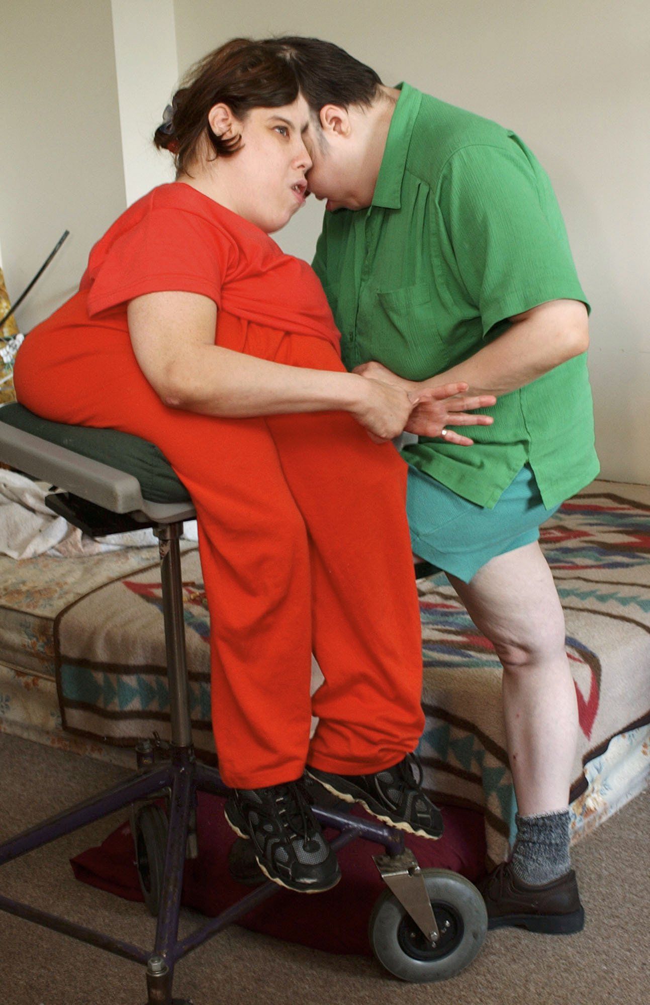 Oldest living conjoined twins, Lori and George Schappell, die at 62 in  Pennsylvania - NZ Herald