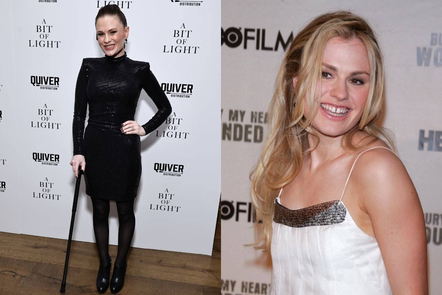 Kiwi star Anna Paquin breaks silence after walking the red carpet with a  cane - NZ Herald