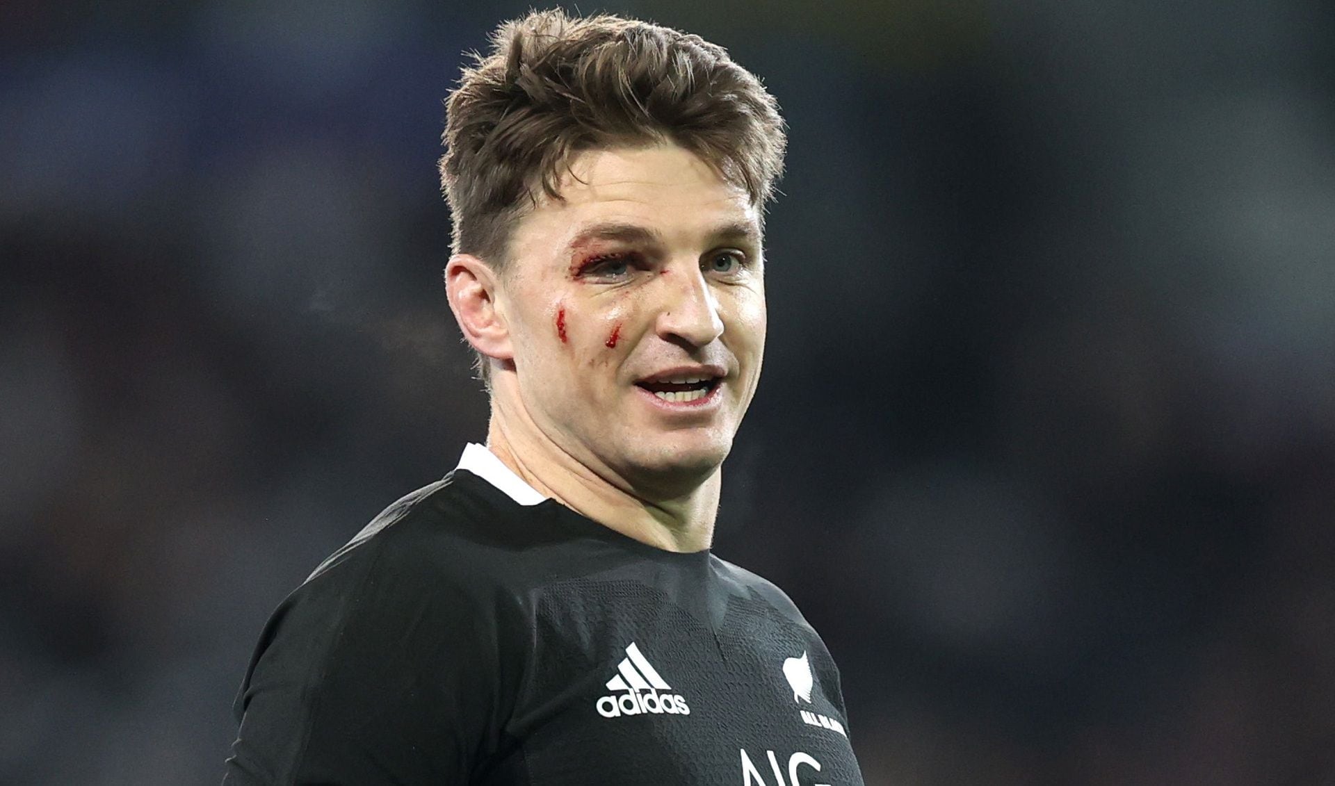 Rugby Beauden Barrett takes another blow to the face in All