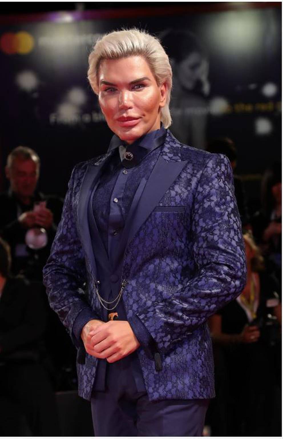 Human Ken Doll Now Unrecognisable After More Surgery Nz Herald