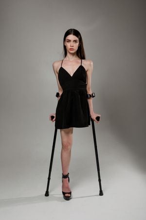 Trolls accuse amputee model of photoshopping off her leg