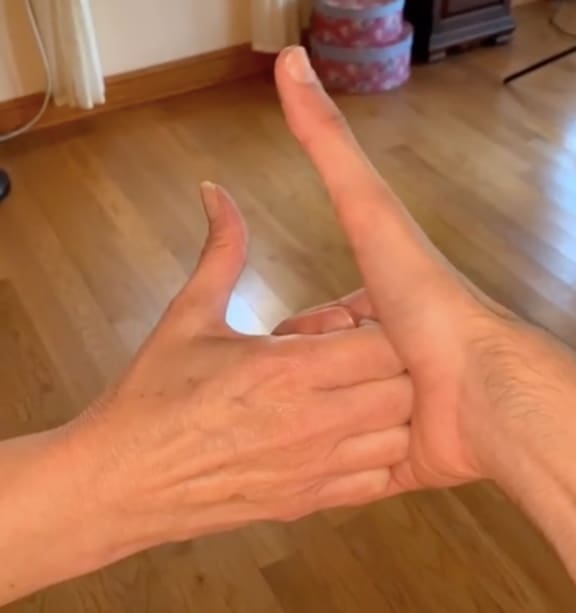 Student with 5-inch-long thumb goes viral. Seen his TikTok videos yet?