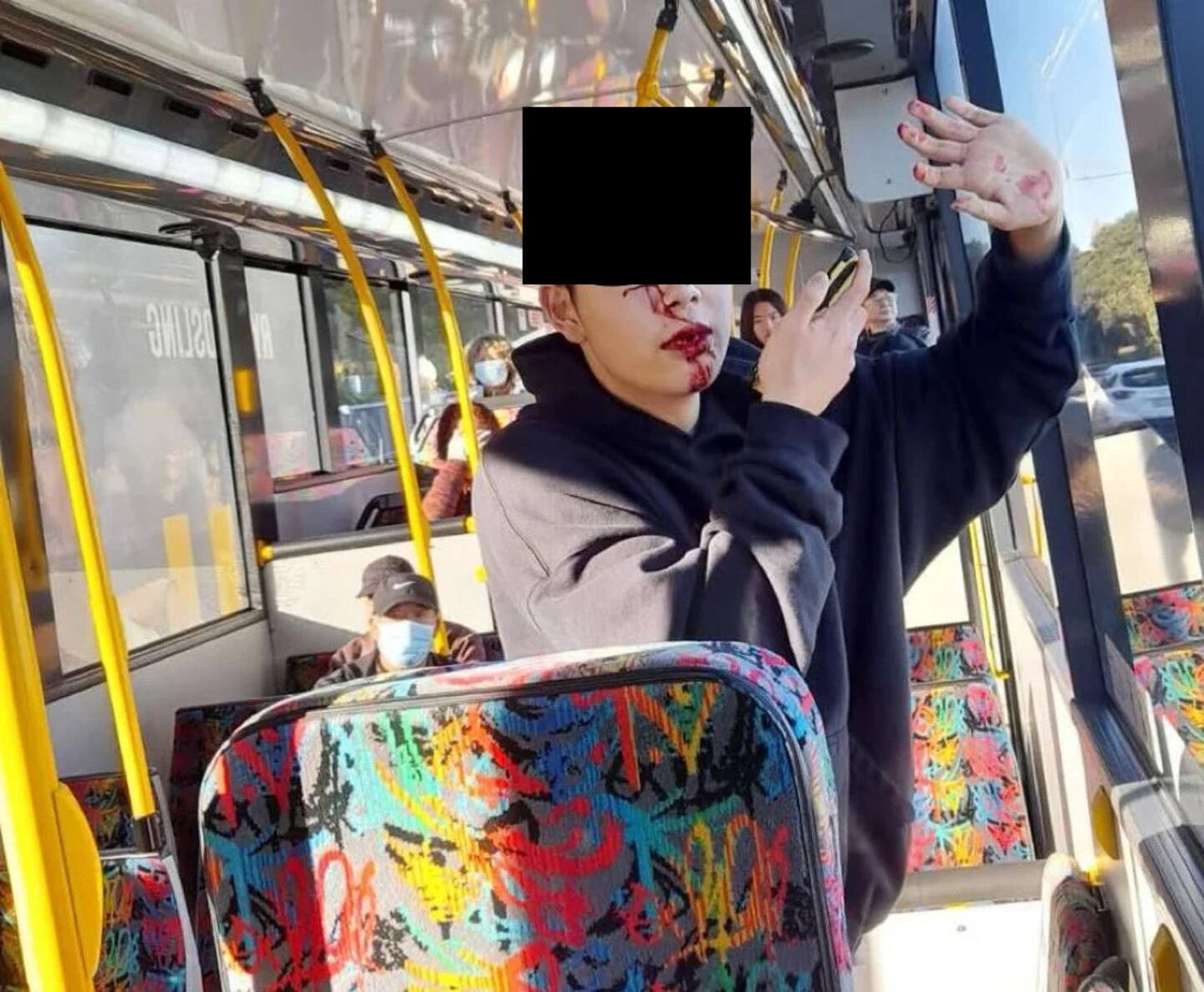这名男学生在奥克兰公交车上遭到随机袭击，三颗牙齿被打掉，另外两颗牙齿被损坏。