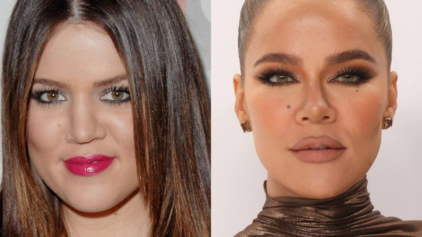 Khloe Kardashian reveals why she 'doesn't miss her old face' amid criticism  - NZ Herald